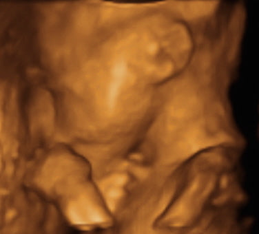 Pregnancy Week image