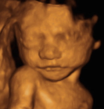 Pregnancy Week image