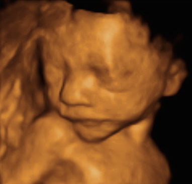 Pregnancy Week image