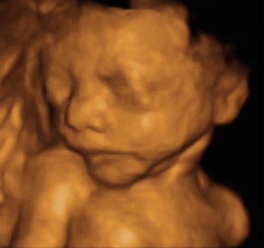 Pregnancy Week image