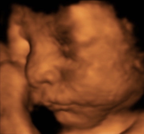 Pregnancy Week image