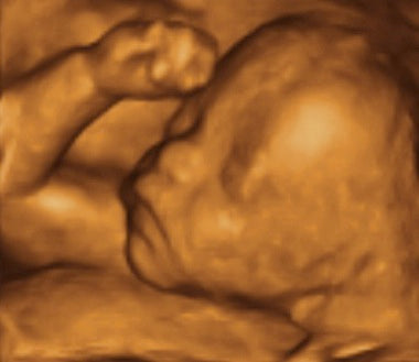 Pregnancy Week image