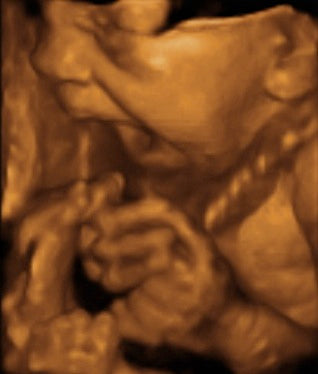 Pregnancy Week image