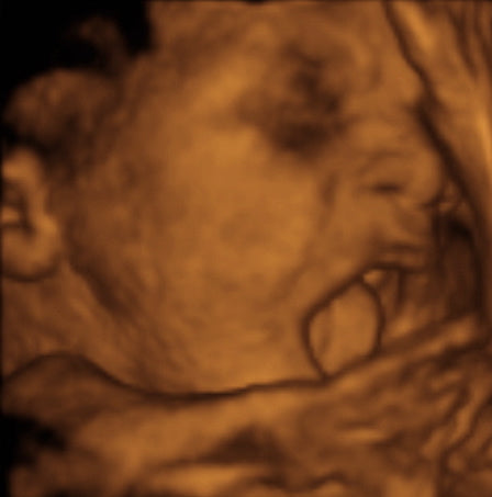 Pregnancy Week image
