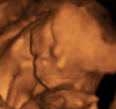 Pregnancy Week image