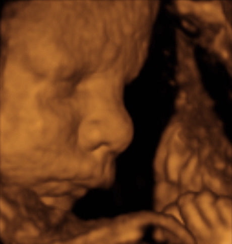 Pregnancy Week image