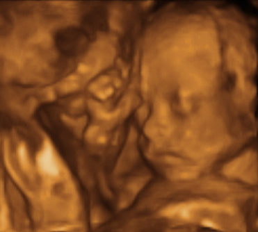 Pregnancy Week image