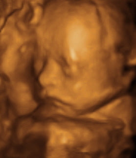 Pregnancy Week image