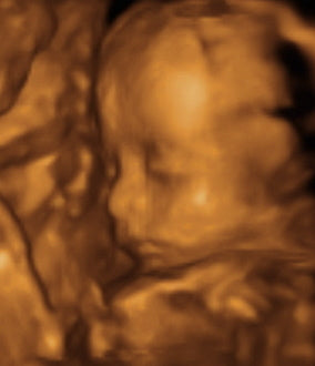 Pregnancy Week image