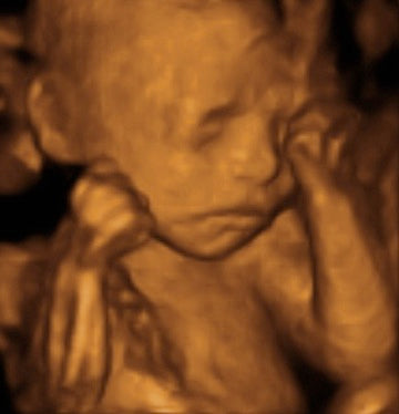 Pregnancy Week image