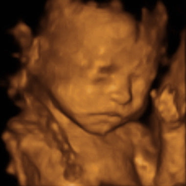 Pregnancy Week image