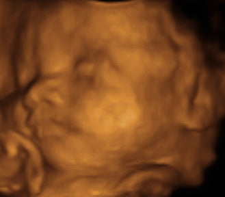 Pregnancy Week image