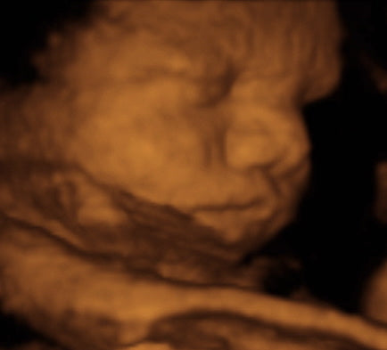 Pregnancy Week image