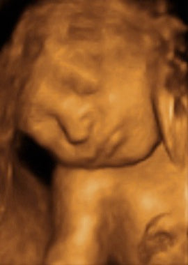 Pregnancy Week image