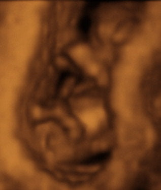 Pregnancy Week image