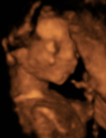 Pregnancy Week image