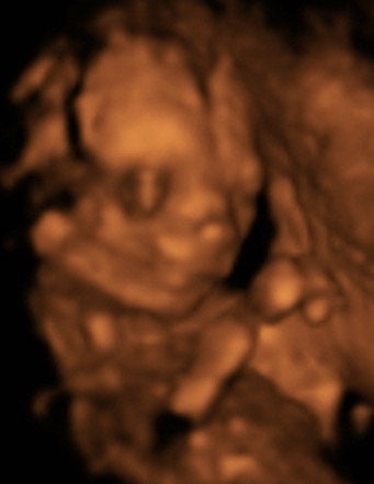 Pregnancy Week image