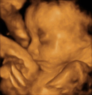 Pregnancy Week image