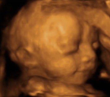 Pregnancy Week image