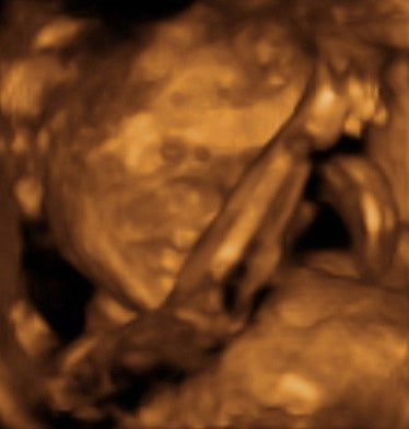 Pregnancy Week image
