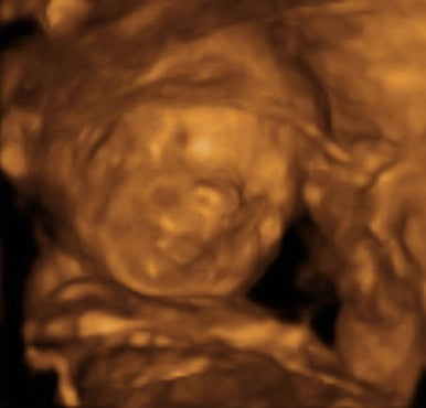 Pregnancy Week image