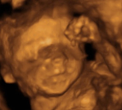 Pregnancy Week image