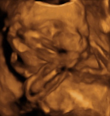 Pregnancy Week image