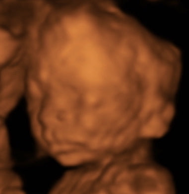 Pregnancy Week image