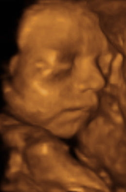 Pregnancy Week image