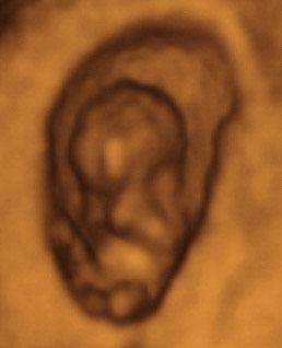 Pregnancy Week image
