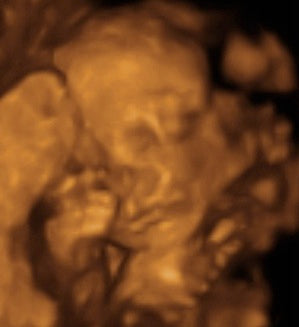 Pregnancy Week image
