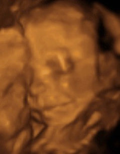 Pregnancy Week image
