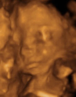 Pregnancy Week image