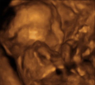Pregnancy Week image