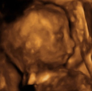 Pregnancy Week image
