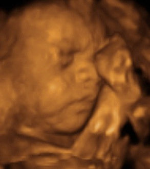 Pregnancy Week image