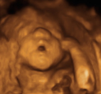 Pregnancy Week image