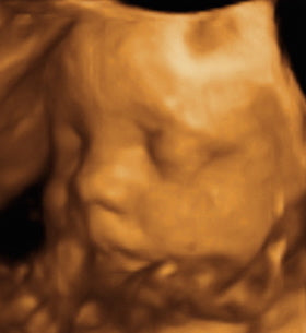 Pregnancy Week image