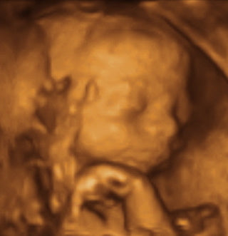Pregnancy Week image