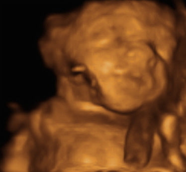 Pregnancy Week image