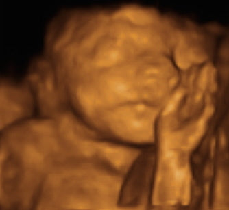 Pregnancy Week image