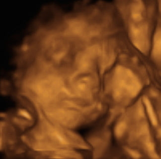 Pregnancy Week image