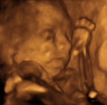 Pregnancy Week image