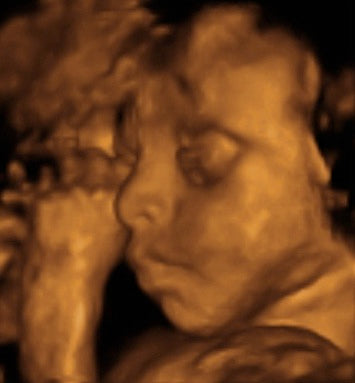 Pregnancy Week image