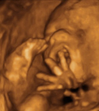 Pregnancy Week image