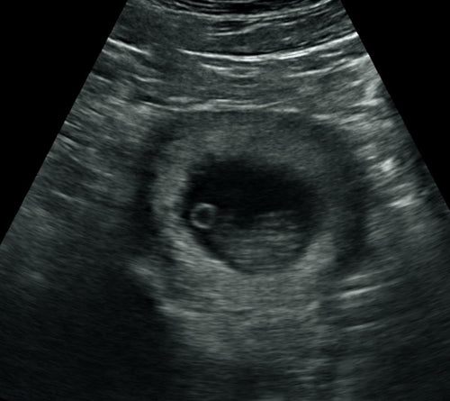 Pregnancy Week image