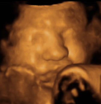 Pregnancy Week image