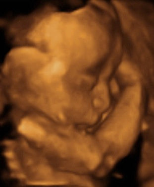 Pregnancy Week image