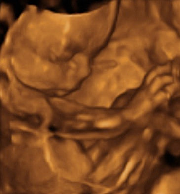 Pregnancy Week image
