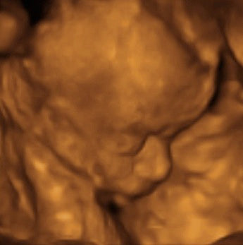 Pregnancy Week image